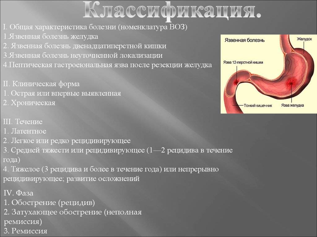 Прободная язва желудка - симптомы, лечение, неотложная помощь